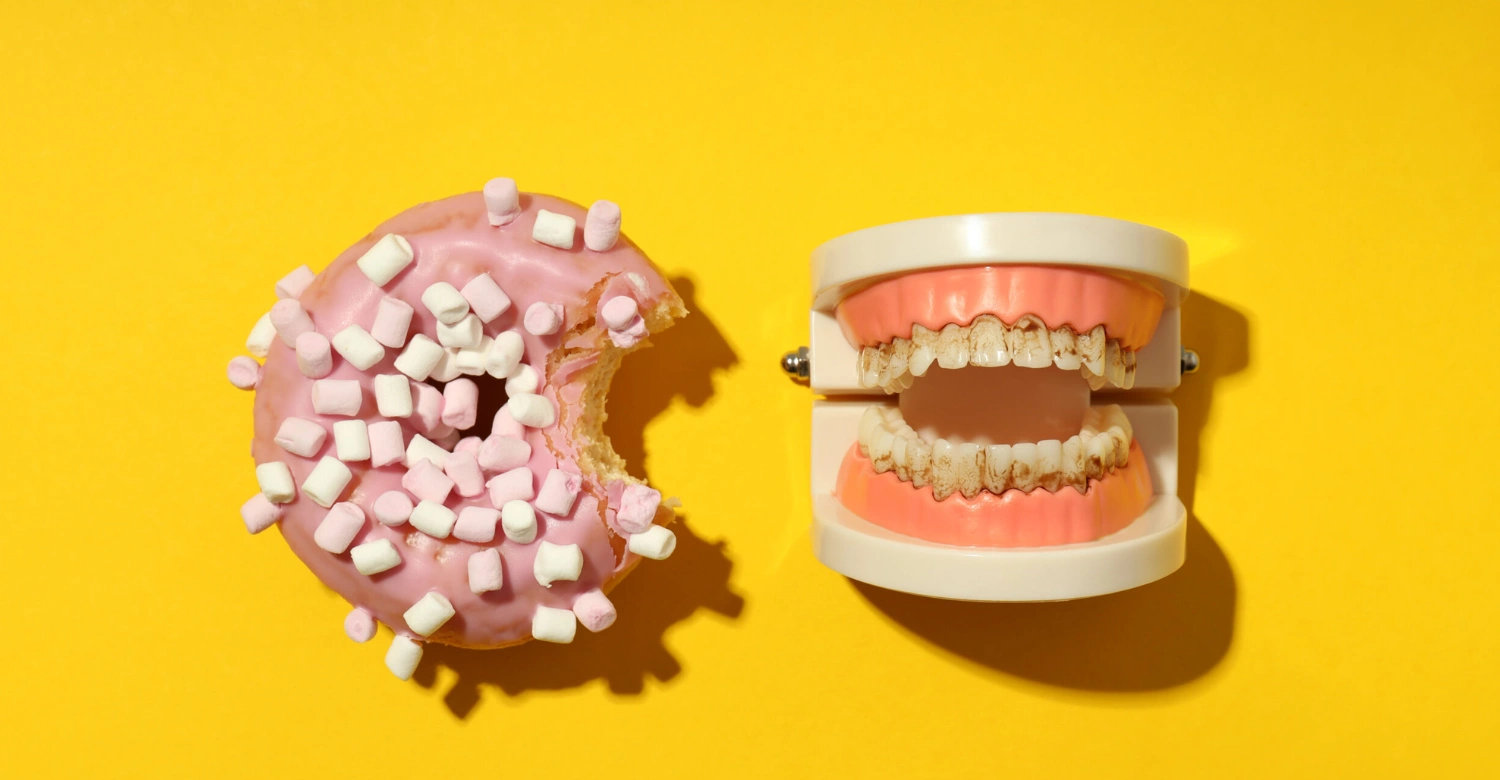 snacks that cause cavities Inblog
